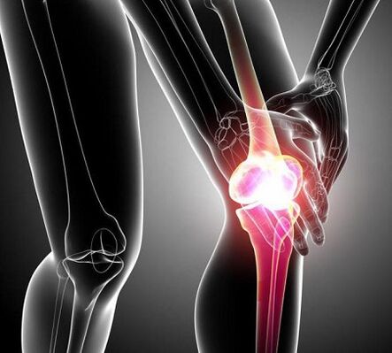 dëmtimi i nyjes së gjurit me artrit dhe artrozë