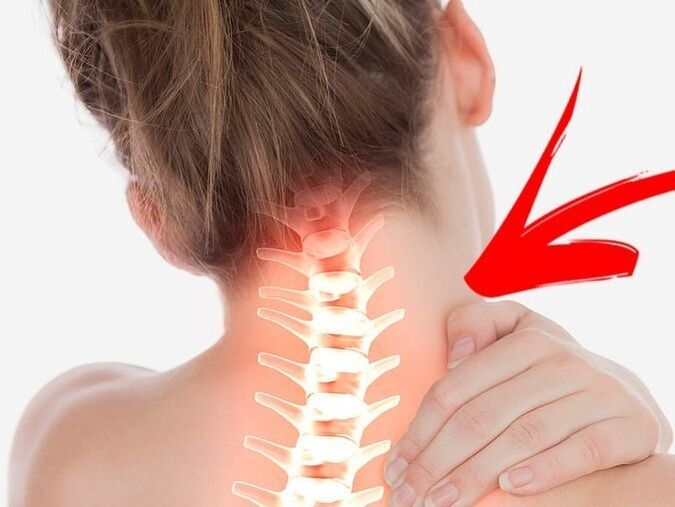 Kompresim i rrënjëve nervore me osteokondrozë të qafës së mitrës