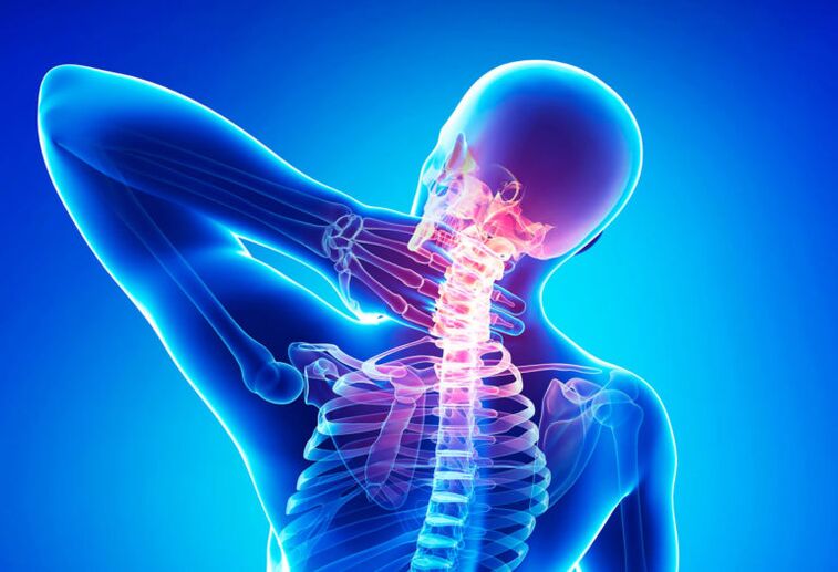 Osteokondroza e shpinës së qafës së mitrës